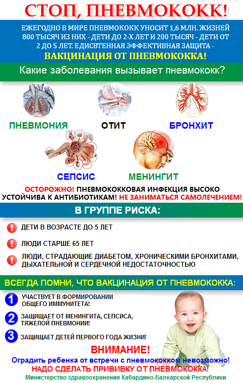 пневмококковая